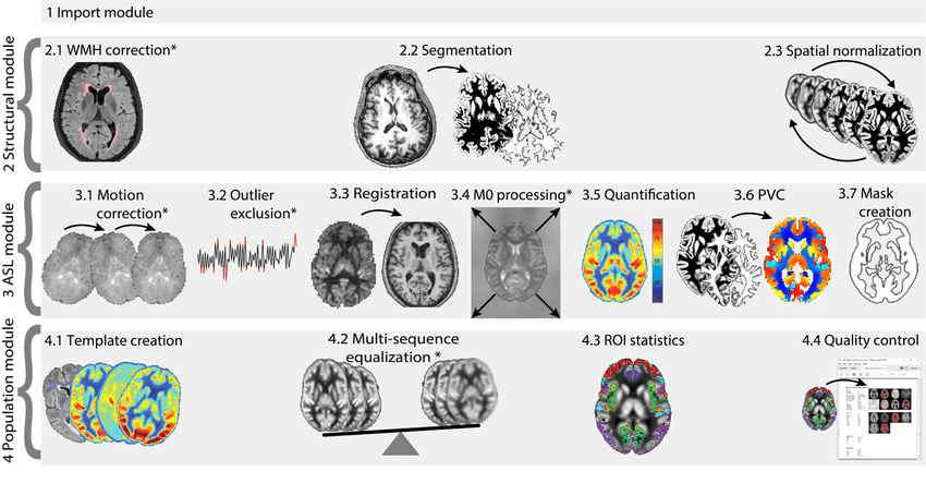 Workflow ExploreASL ExploreASL Workflow